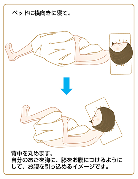 無痛分娩の処置時に横向きで背中を丸める姿勢の説明図